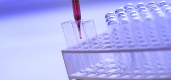 Microcefalie e virus Zika: similitudini dimostrate in uno studio condotto dall’Università di Torino
