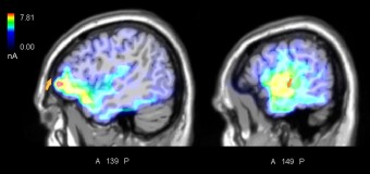 Musica e movimento, ecco come il cervello impara dagli errori altrui