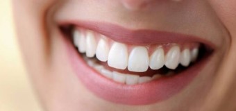 Odontoiatria estetica: di cosa si tratta?
