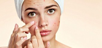 L’acne, può non essere più un vostro problema!