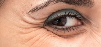 Prevenire e combattere le rughe del viso e del contorno occhi